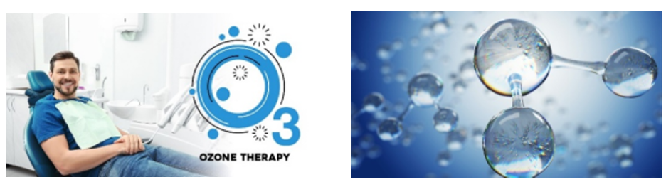Ozone Therapy Treatment