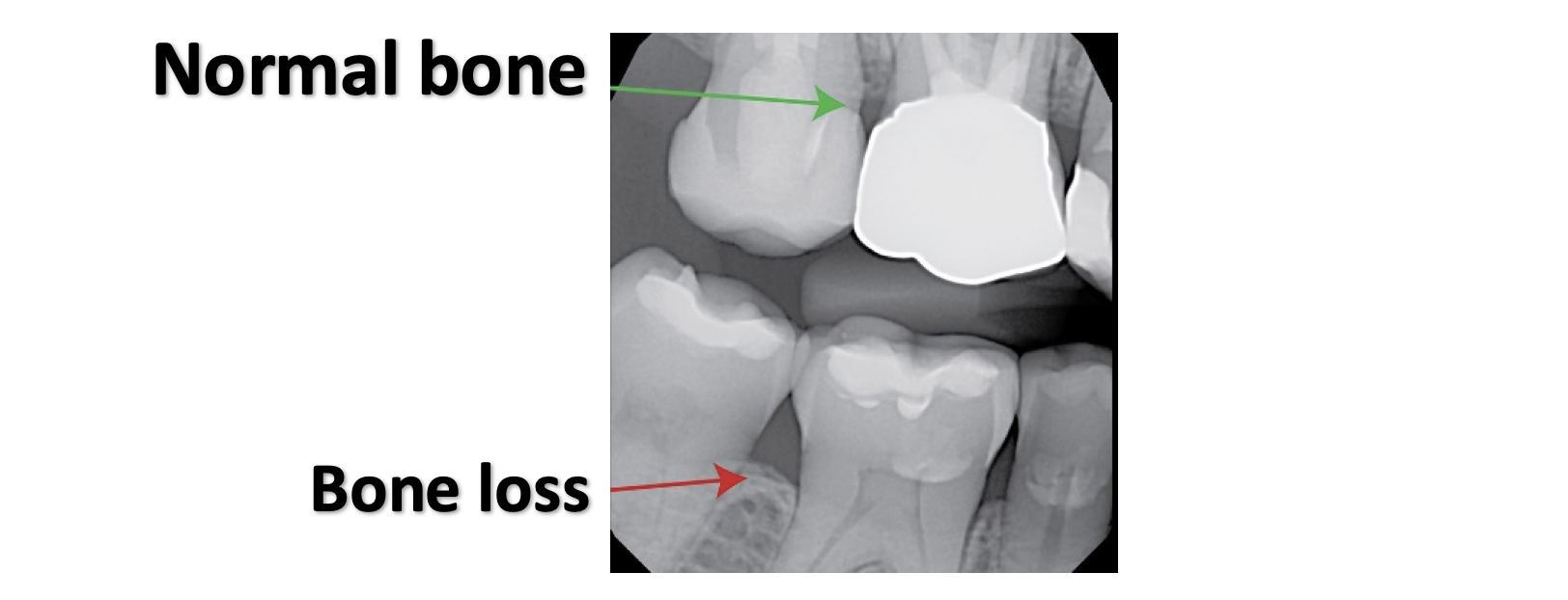 Are Dental Xrays Safe? Know with Breath & Bite